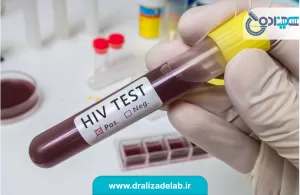 انواع آزمایش های تشخیصی برای عفونت HIV